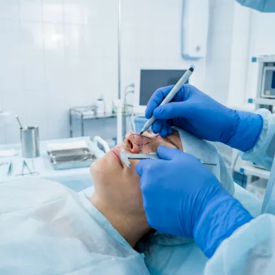 Nazal polip cerrahisi